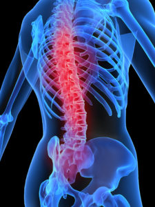 neck and back pain after a car accident