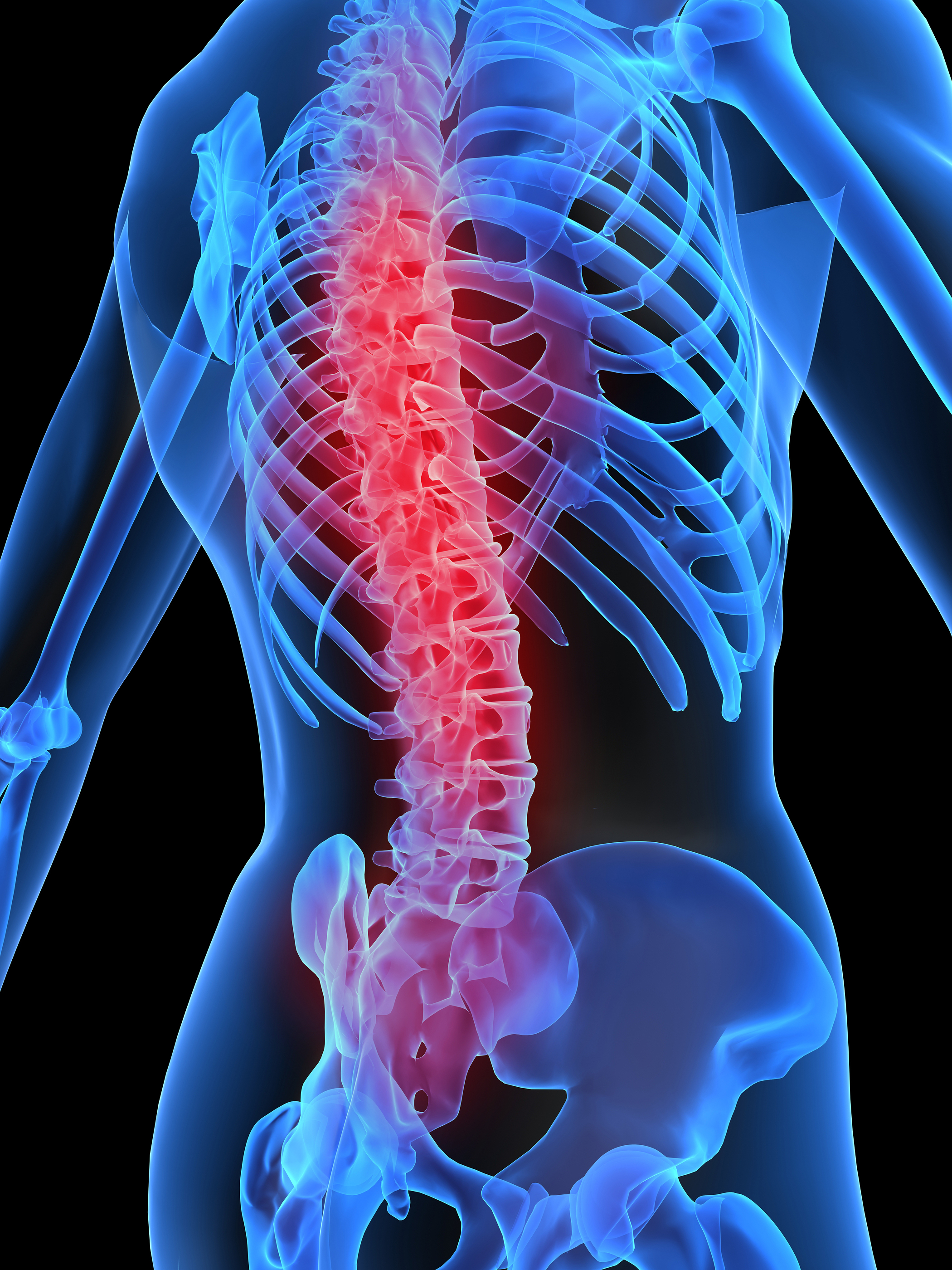 Treating Neck and Back Pain After an Accident