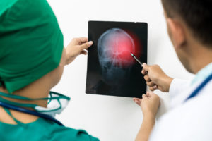 doctors concussion and their effects